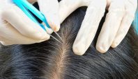 Ilustrasi 5 cara perawatan rambut uban.