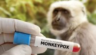 Penemuan 1 kasus cacar monyet di Bandung (iStockphoto ).