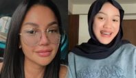 Hasil visum kedua yang dilakukan pada Laura Meizani Nasseru Asry alias Lolly anak Nikita Mirzani keluar (Instagram).