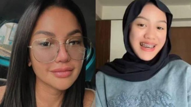 Hasil visum kedua yang dilakukan pada Laura Meizani Nasseru Asry alias Lolly anak Nikita Mirzani keluar (Instagram).