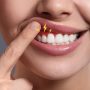 Kesehatan Gusi