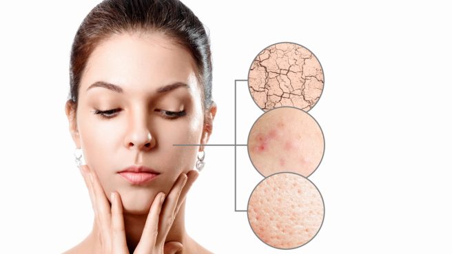 Kulit Bermasalah Saat Musim Hujan